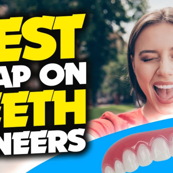 7 Facts to Know Before Buying Snap-On Veneers Online