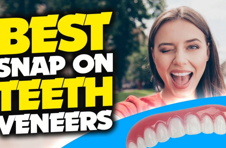 7 Facts to Know Before Buying Snap-On Veneers Online