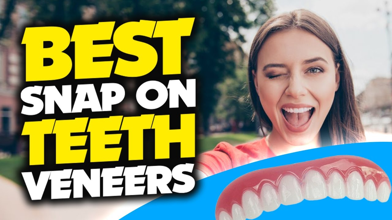 7 Facts to Know Before Buying Snap-On Veneers Online