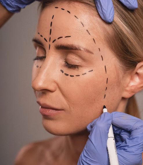 Why Sculptra Treatments in Fresno CA, Are Gaining Popularity for Facial Volume Restoration