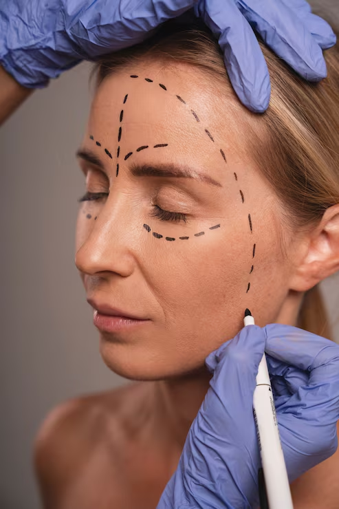 Why Sculptra Treatments in Fresno CA, Are Gaining Popularity for Facial Volume Restoration